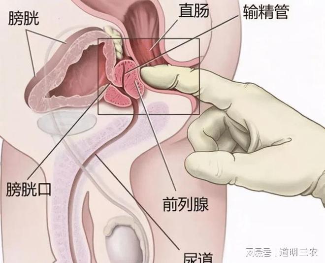 前列腺尿痛尿急尿频吃什么药好,基于数据分析驱动的解析，前列腺尿痛尿急尿频症状的药物选择及Harmony78.58.84的潜在关联,实地研究解析说明_Executive36.69.94