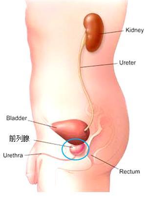 前列腺病的症状应该买什么,前列腺病的症状及应对方案，了解症状与选购指南,深度数据应用实施_WP33.52.42