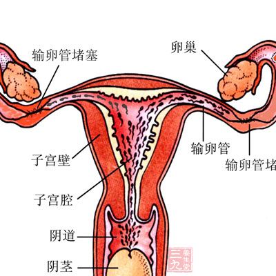 子宫下垂能过性生活么,关于子宫下垂与性生活的关系——准确资料解析,深入应用数据执行_简版80.28.88